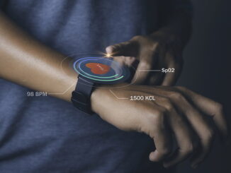 Smartwatches
